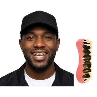 Arany Grillz Fogsor Felnőtteknek